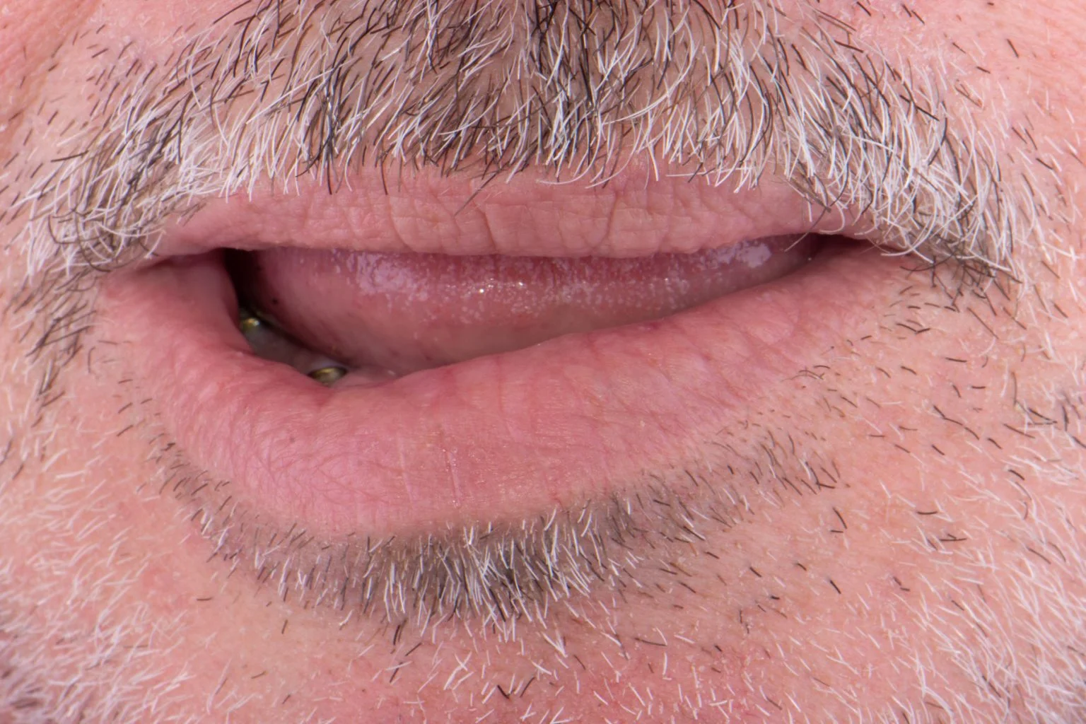 Before treatment