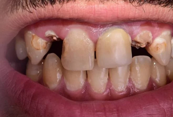 Before treatment