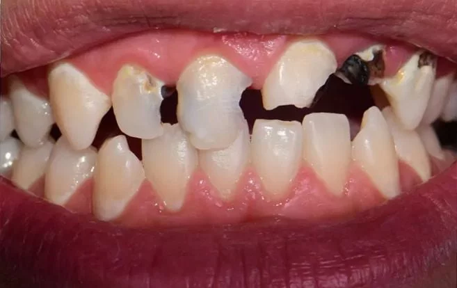Before treatment