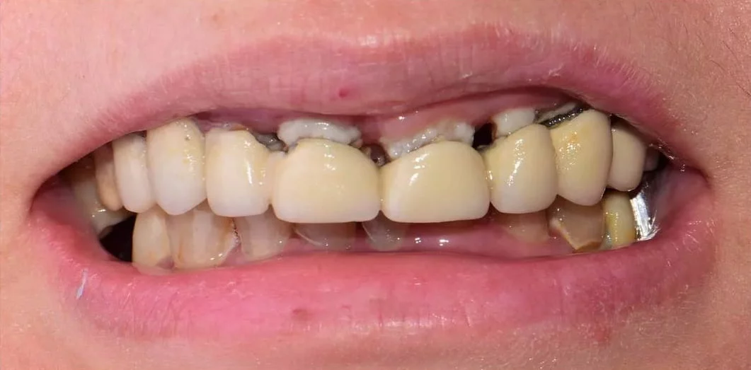 Before treatment