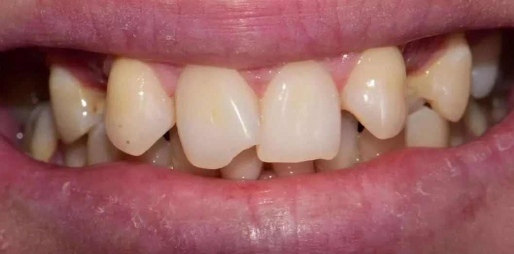 Before treatment