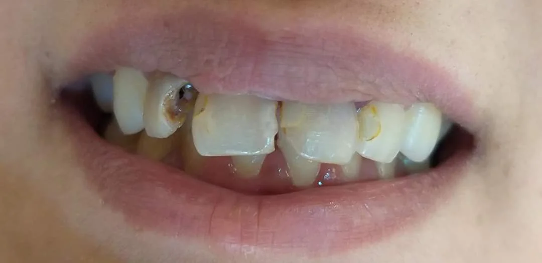 Before treatment