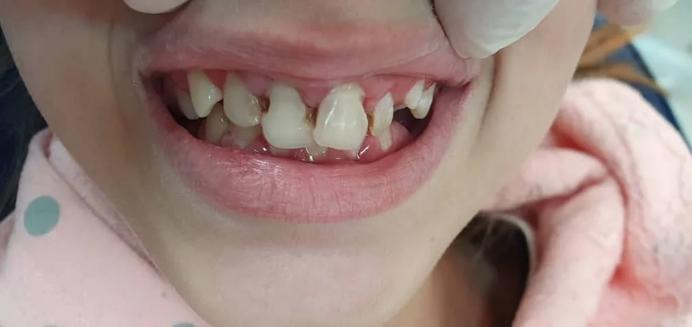 Before treatment