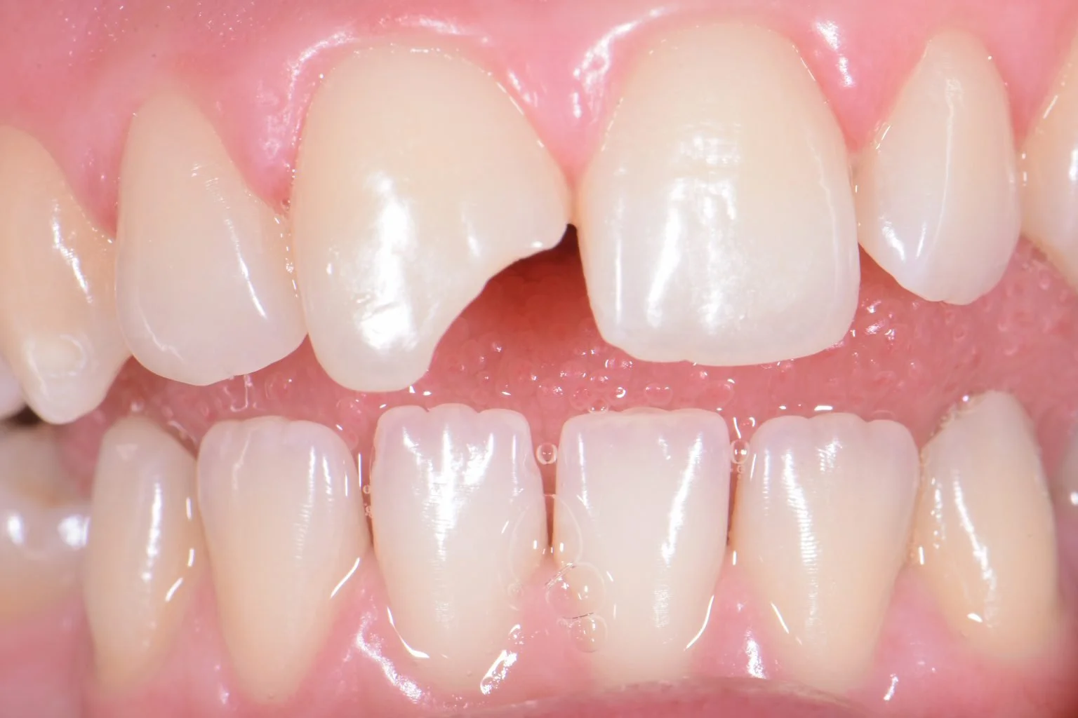 Before treatment