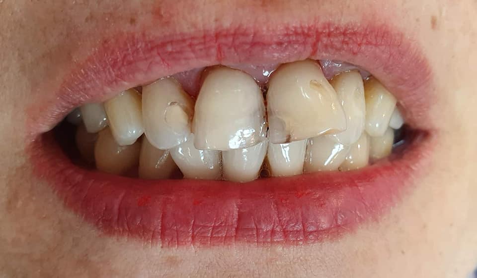 Before treatment
