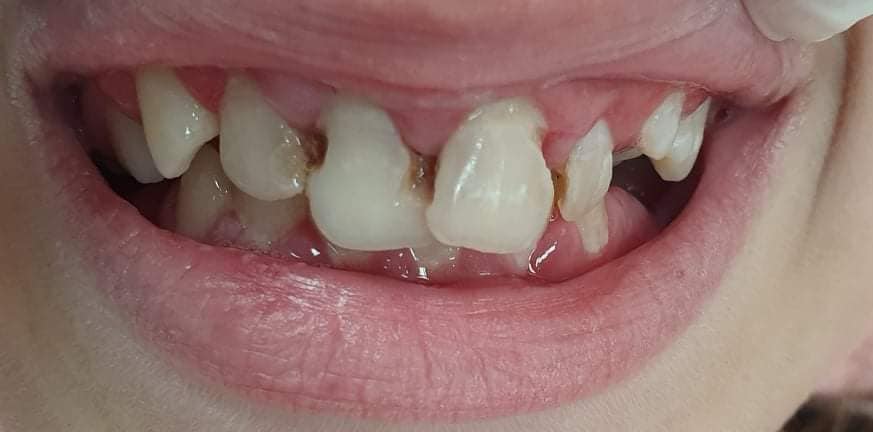 Before treatment