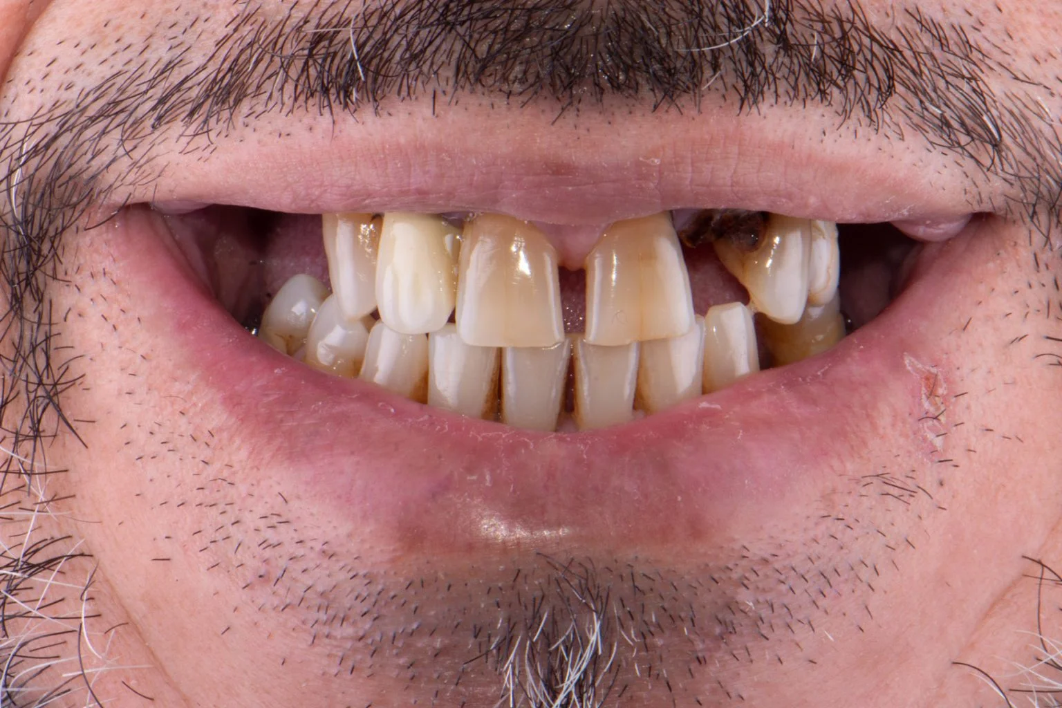 Before treatment